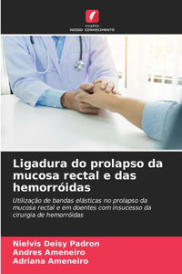 Ligadura do prolapso da mucosa rectal e das hemorróidas