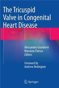 Tricuspid Valve in Congenital Heart Disease