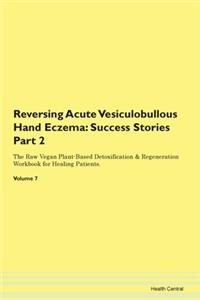 Reversing Acute Vesiculobullous Hand Ecz