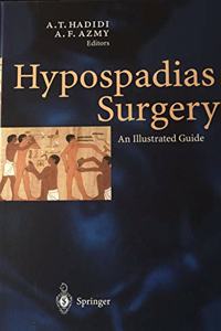 Hypospadias Surgery