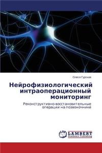 Neyrofiziologicheskiy intraoperatsionnyy monitoring