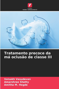 Tratamento precoce da má oclusão de classe III