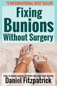 Fixing Bunions Without Surgery
