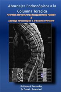 Abordajes Endoscopicos a la Columna Toracica