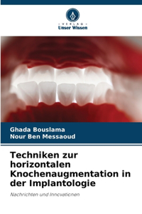 Techniken zur horizontalen Knochenaugmentation in der Implantologie