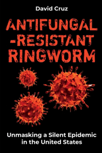 Antifungal-Resistant Ringworm
