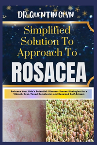 Simplified Solution Approach To ROSACEA