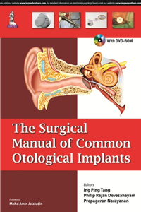 The Surgical Manual of Common Otological Implants