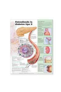 Understanding Type 2 Diabetes Anatomical Chart in Spanish (Comprendiendo la diabetes tipo 2)