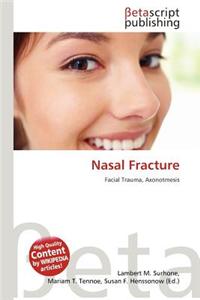 Nasal Fracture