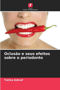 Oclusão e seus efeitos sobre o periodonto