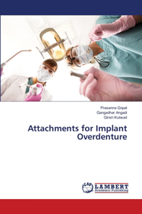 Attachments for Implant Overdenture
