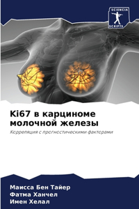 Ki67 в карциноме молочной железы