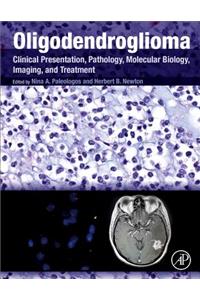 Oligodendroglioma