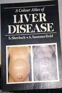 A Colour Atlas of Liver Disease