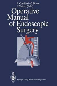 Operative Manual of Endoscopic Surgery