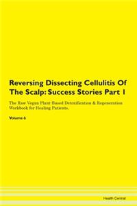 Reversing Dissecting Cellulitis of the S