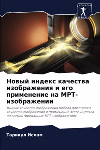 Новый индекс качества изображения и его 
