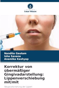 Korrektur von übermäßiger Gingivadarstellung