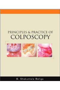 Principles and Practice of Colposcopy