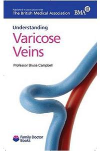 Understanding Varicose Veins