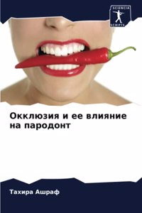Окклюзия и ее влияние на пародонт