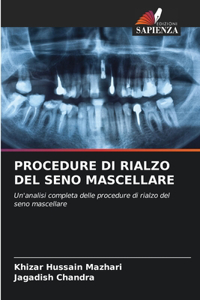 Procedure Di Rialzo del Seno Mascellare