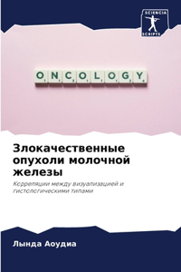 Злокачественные опухоли молочной желез