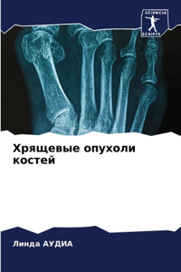 Хрящевые опухоли костей
