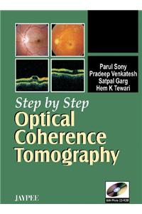 Step by Step: Optical Coherence Tomography