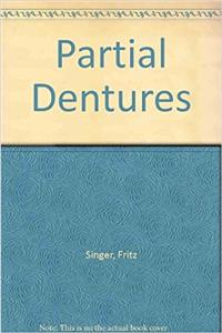 Partial Dentures