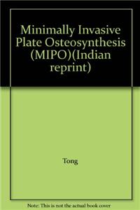 Minimally Invasive Plate Osteosynthesis (MIPO): Concepts and cases presented by the AO East Asia (Indian reprint) Book & DVD