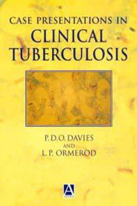 Case Presentation in Clinical Tuberculosis