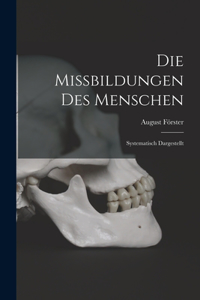 Missbildungen Des Menschen