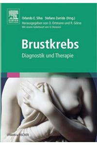 Brustkrebs