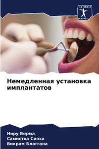 Немедленная установка имплантатов