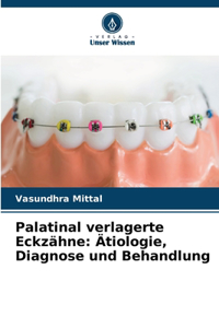 Palatinal verlagerte Eckzähne