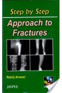 Step by Step Approach To Fractures