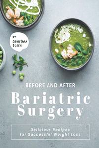 Before and After Bariatric Surgery