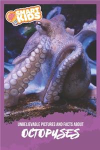 Unbelievable Pictures and Facts About Octopuses