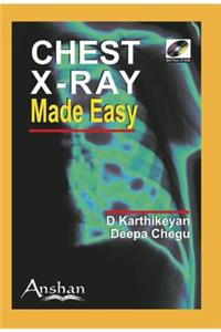 Chest X-Ray