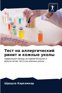 Тест на аллергический ринит и кожные уколm