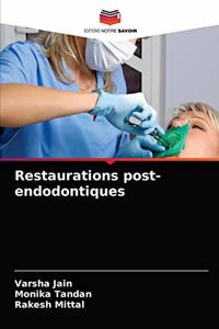 Restaurations post-endodontiques