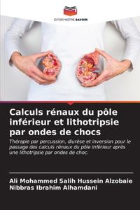 Calculs rénaux du pôle inférieur et lithotripsie par ondes de chocs