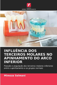 Influência DOS Terceiros Molares No Apinhamento Do Arco Inferior