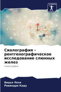 Сиалография - рентгенографическое исслед