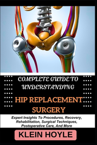 Complete Guide to Understanding Hip Replacement Surgery