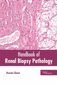 Handbook of Renal Biopsy Pathology
