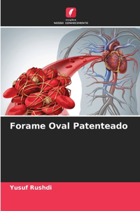 Forame Oval Patenteado