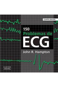 150 Problemas de ECG